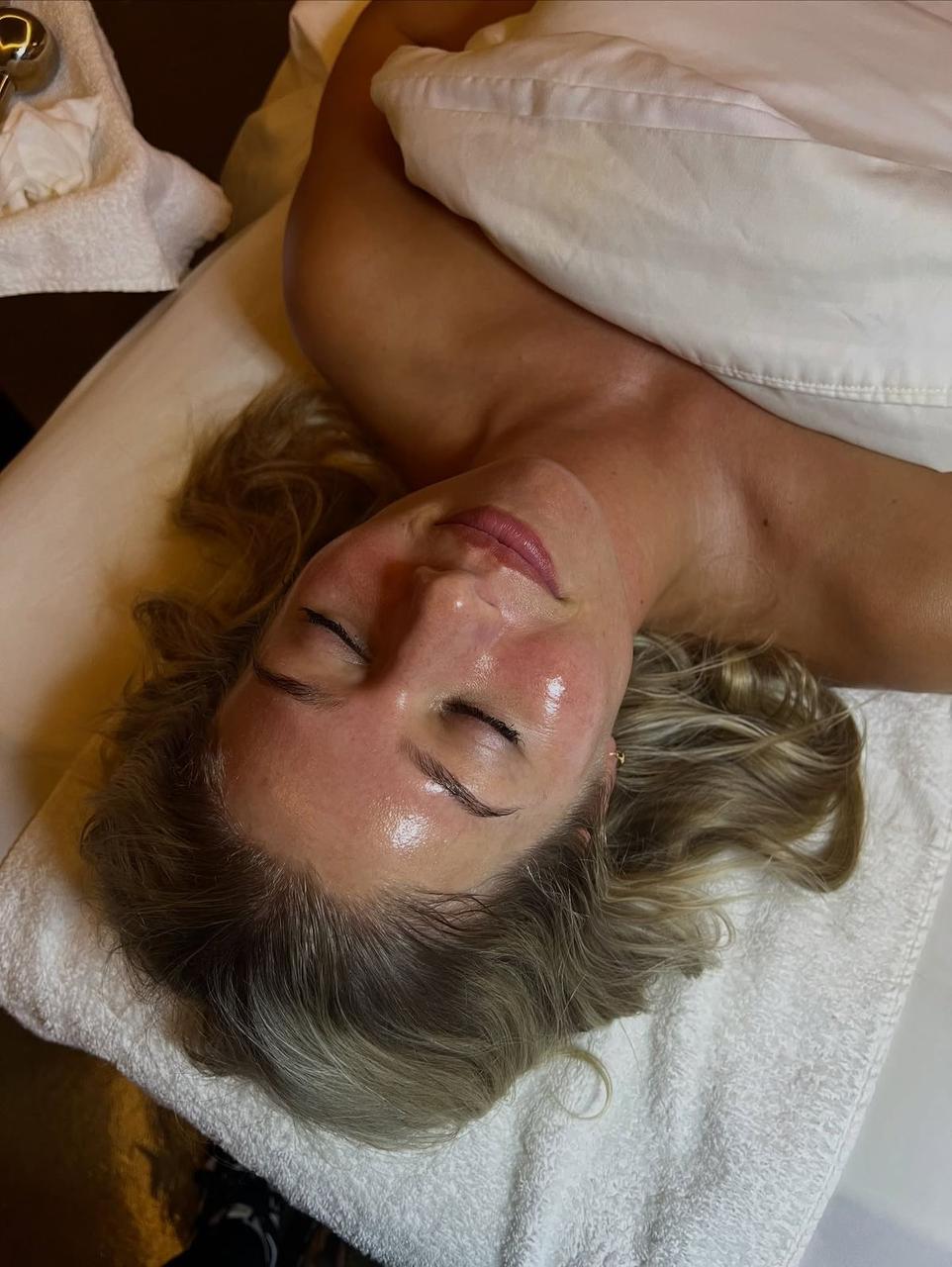 Tratamiento Dermapen para mejorar textura y manchas de la piel